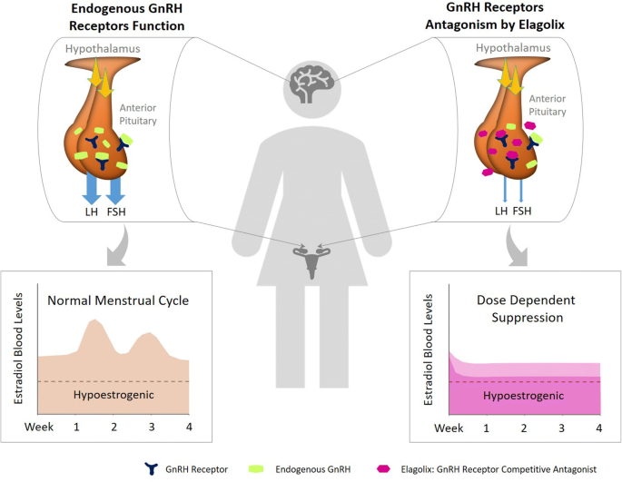 Elagolix Sodium: Advancing Treatment Options in Women's Health